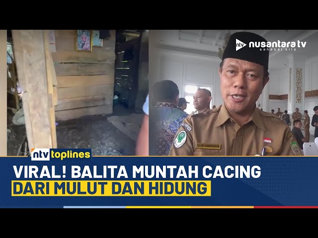 Youtube Thumnail image of : Viral Diduga Cacingan Akut, Balita di Bengkulu Muntahkan Cacing di Tubuhnya | NTV TOPLINES