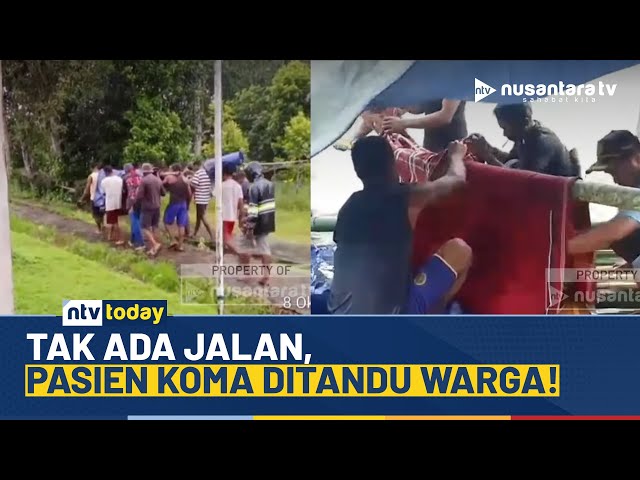 Youtube Thumnail image of : Pasien Koma di Seram Barat Ditandu Warga Menuju Puskesmas Terdekat | NTV TODAY